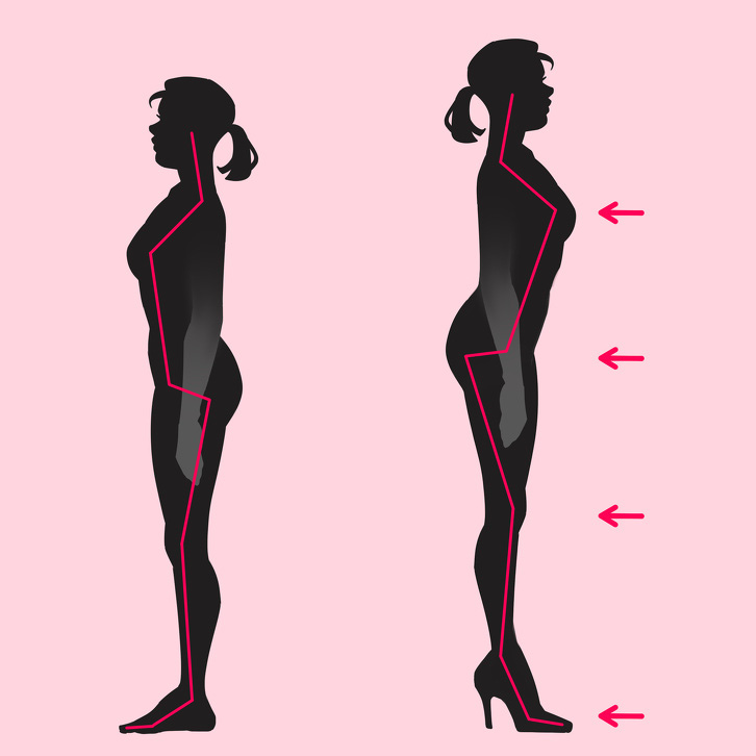 3 bộ phận cơ thể sẽ bị ảnh hưởng khi bạn thường xuyên đi giày cao gót