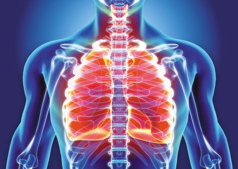 9 căn bệnh dễ mắc do ô nhiễm không khí