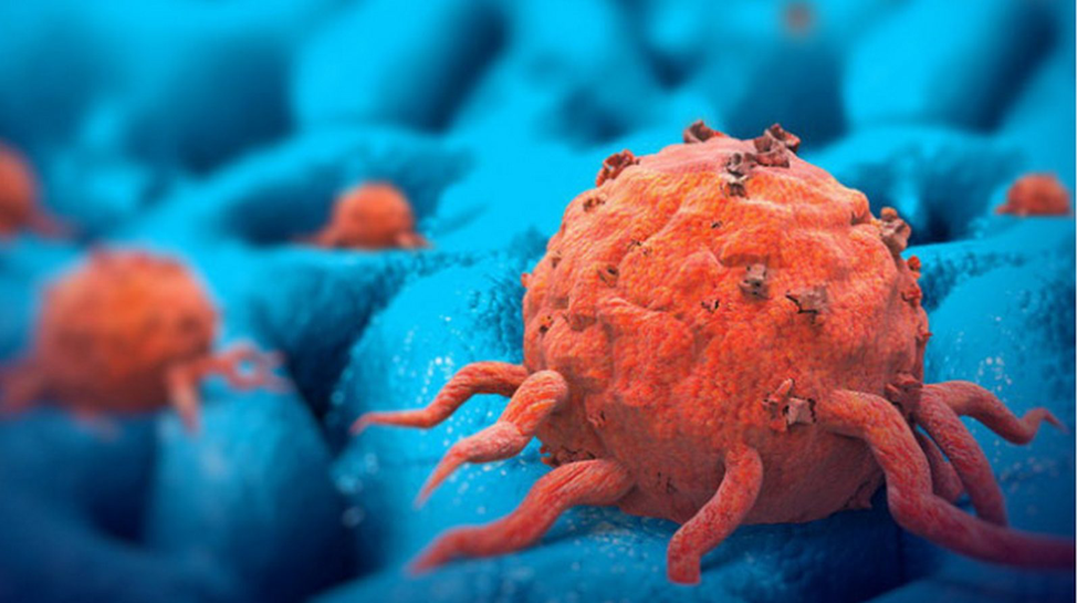 Nguyên nhân và điều kiện gây ra bệnh ung thư