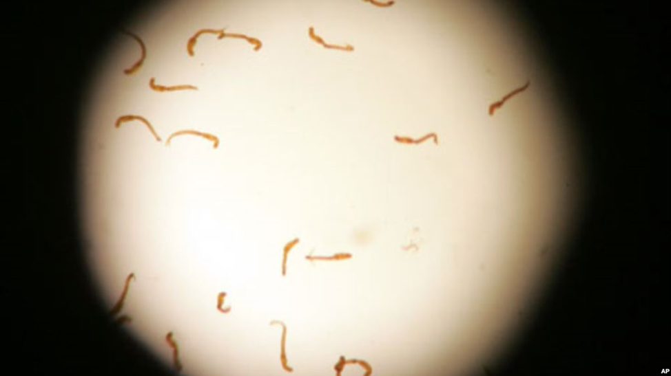 dau hieu tre nhiem giun