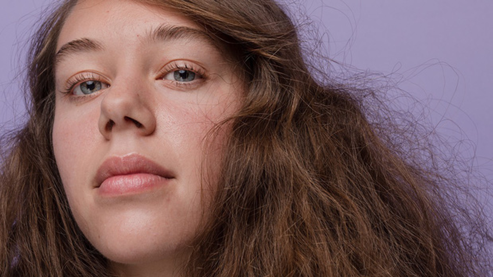 Người có gan kém thường có 3 biểu hiện này trên khuôn mặt - check ngay!